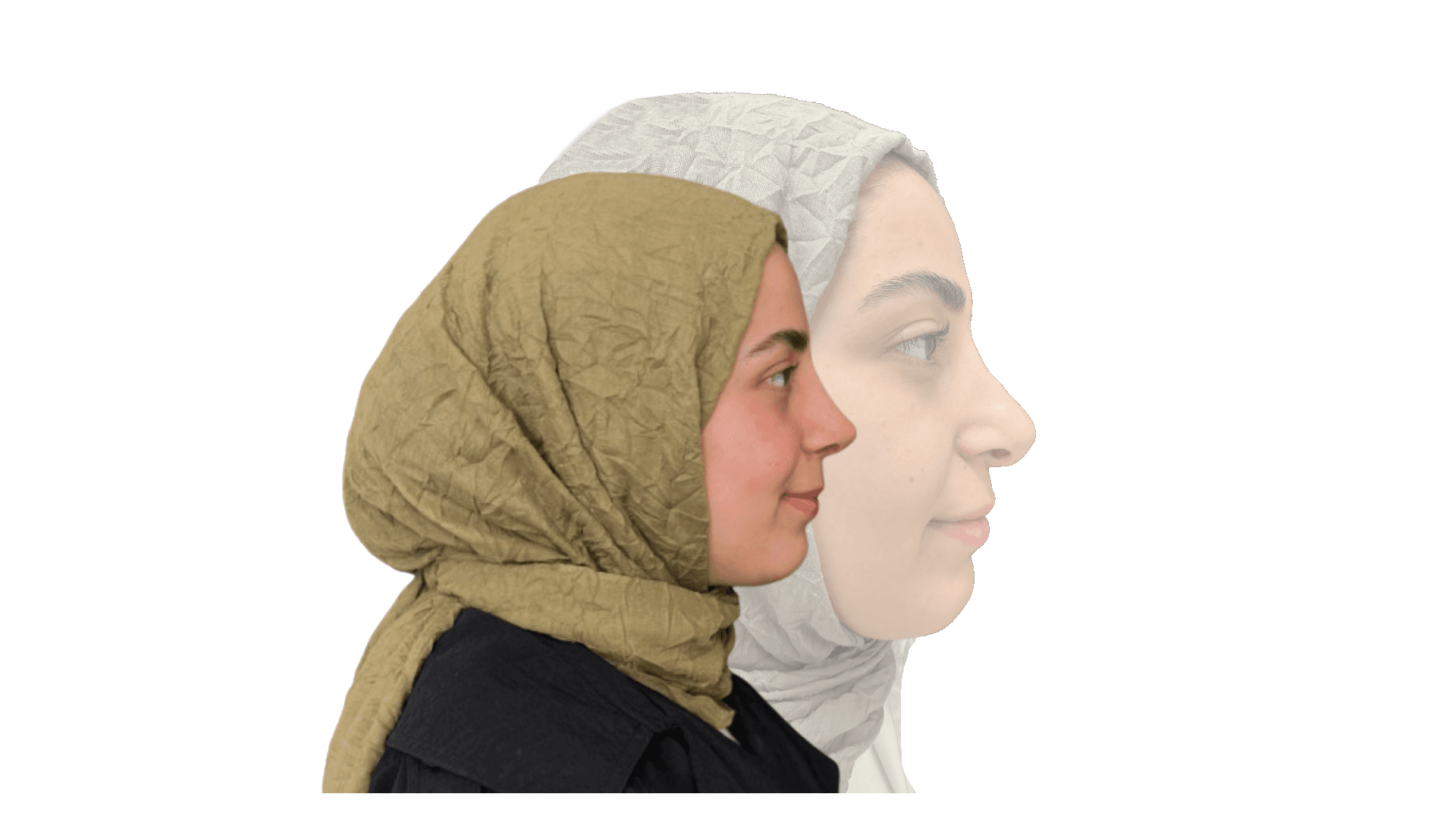 Revision Rhinoplasty